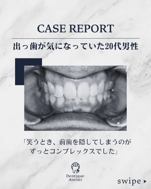 デンティーク アトリエ Instagram CASE REPORT