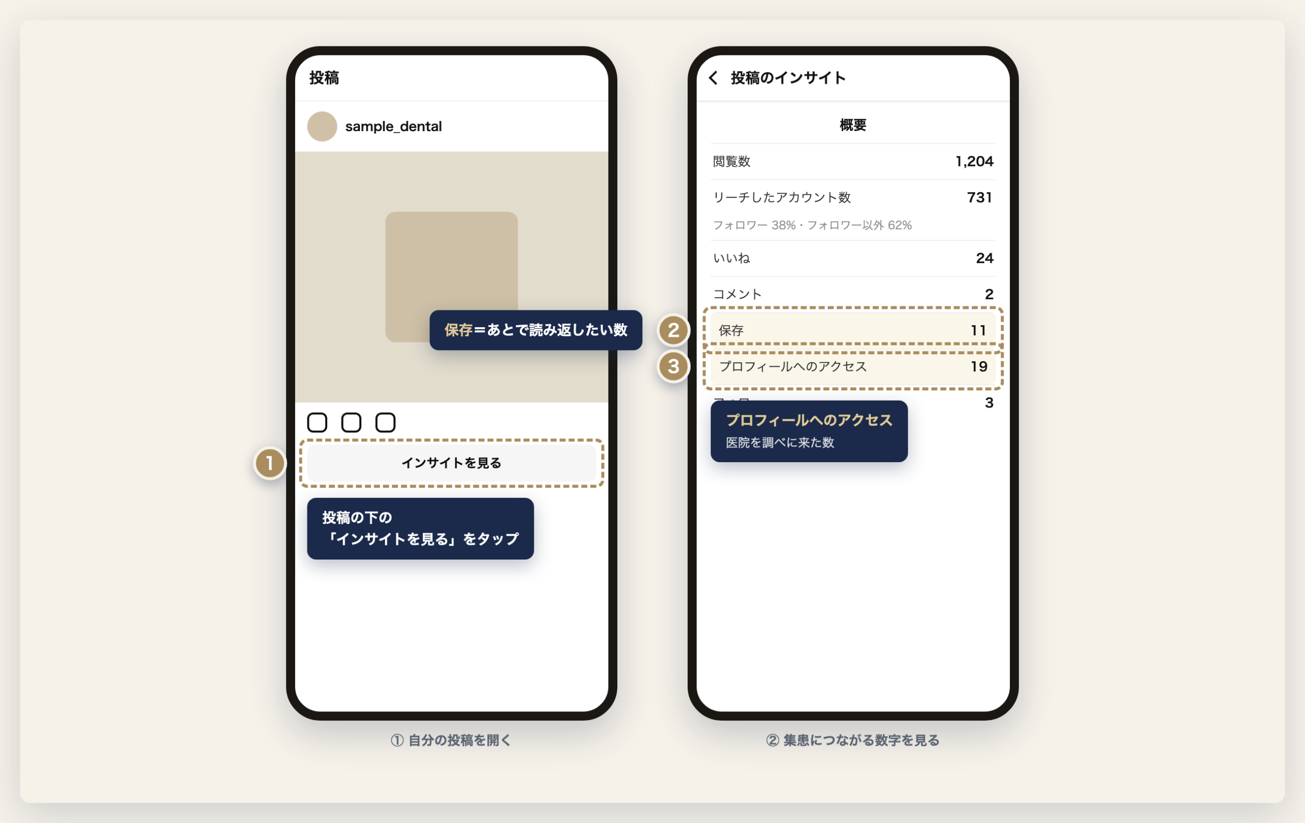 投稿ごとのインサイトの見方(保存・プロフィールへのアクセス)