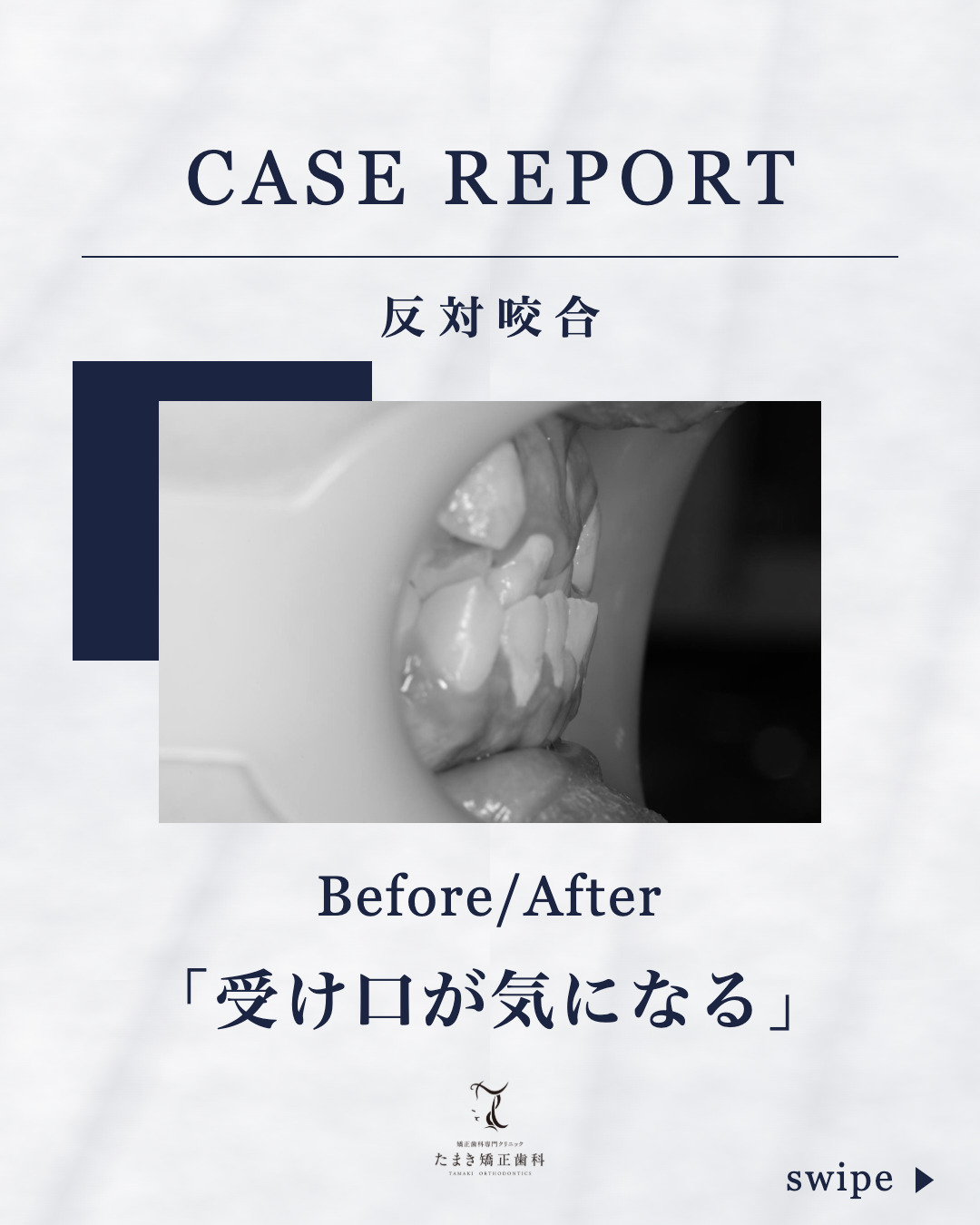 @dr.hironori_tamaki.sapporo 👈他の投稿もチェック👀