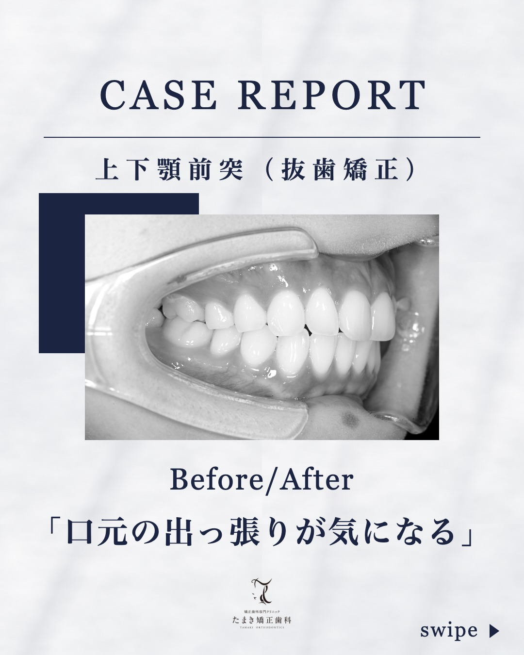 @dr.hironori_tamaki.sapporo 👈他の投稿もチェック👀