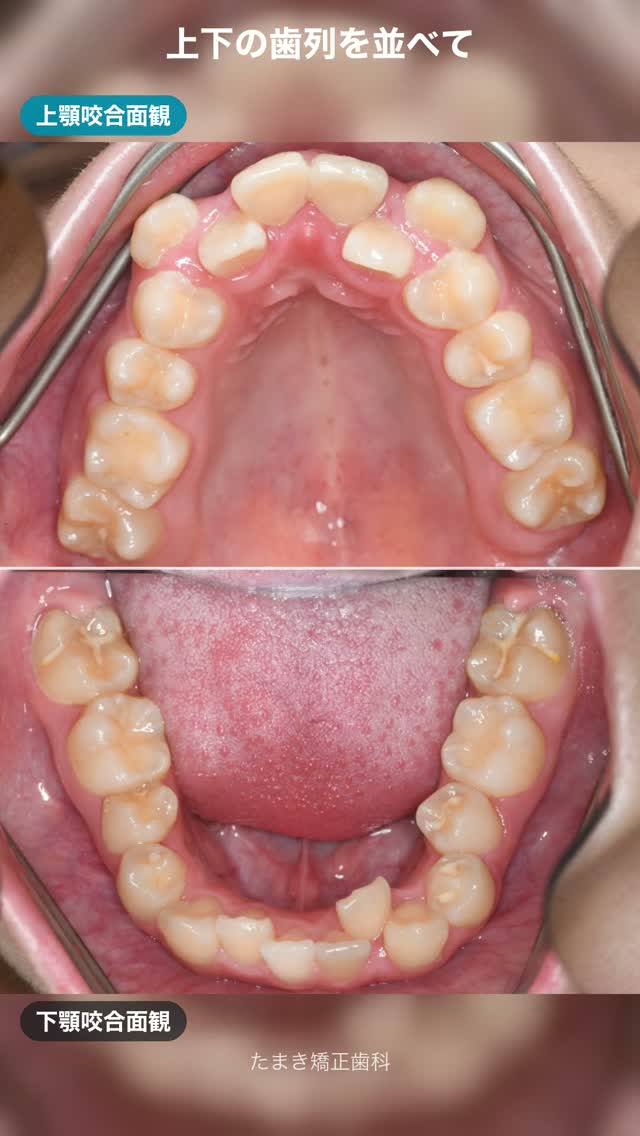 @dr.hironori_tamaki.sapporo 👈他の投稿もチェック👀
